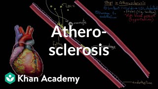 Atherosclerosis  Circulatory System and Disease  NCLEXRN  Khan Academy [upl. by Alvord846]