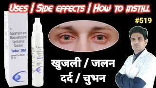 Tobramycin dexamethasone eye drops  Toba dm eye drops uses in hindi  Tobradex eye drops use [upl. by Iew95]