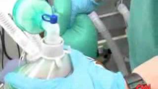 How does a Propofol injection work Dr Sanjay Gupta and Dr Raphael Gershon on CNN [upl. by Hutchins]