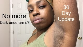 Lightening my underarms  30 day update [upl. by Gwendolyn]