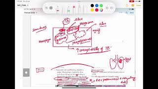 Pneumoconiosis Asbestosis Silicosis Berylliosis coal work Respiratory 42 First Aid USMLE Step1 [upl. by Burrell486]