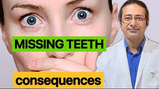 How to identify missing teeth problemsDisadvantages of missing teeth [upl. by Miculek569]