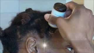 Comment favoriser la repousse des cheveux sur les tempes [upl. by Yesllek]