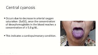 Cyanotic Congenital Heart Disease En  Soha Romeih [upl. by Ayo]