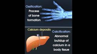 Ossification Vs Calcification [upl. by Ehcram]