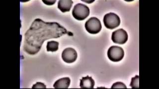 Neutrophil Phagocytosis  White Blood Cell vs Staphylococcus Aureus Bacteria [upl. by Sachs628]