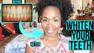 How to Whiten Teeth FAST amp NATURALLY  SIMPLE Cleaning amp Teeth Brushing Routine [upl. by Zil647]