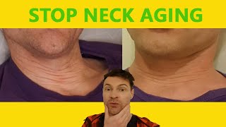 Get rid of neck lines amp get a more youthful neck [upl. by Tewell81]