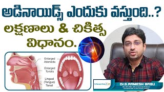 అడినాయిడ్స్ ఎందుకు వస్తుంది  Adenoids or Adenoid Hypertrophy Treatment  Dr Ramesh Babu ENT [upl. by Dry]