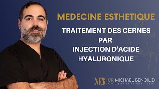 LE TRAITEMENT DES CERNES PAR INJECTION DACIDE HYALURONIQUE [upl. by Yablon]