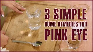 3 Simple Natural Home Remedies For PINK EYE TREATMENT [upl. by Amlus]