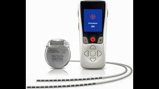 Boston Scientific Spinal Cord Stimulator Post Op Visit [upl. by Togram191]