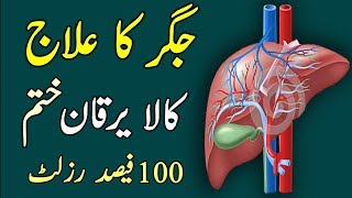 Jigar Ka Desi Ilaj  Kala Yarqan Ka Ilaj Treatment For Hepatitise C amp B In UrduHindi [upl. by Euqinwahs345]