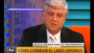 Labio leporino cirugías  Telefe Noticias [upl. by Attelahs]