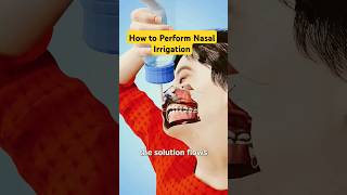 How to Perform Nasal Irrigationshorts shortsfeed [upl. by Nirot242]