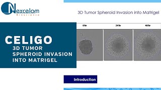 Celigo 3D Tumor Spheroid Invasion into Matrigel [upl. by Sakram130]