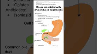 Drugs associated with druginduced pancreatitis [upl. by Bernette]