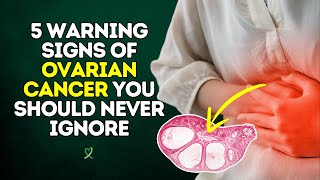 5 Early Warning Signs of Ovarian Cancer You Should Never Ignore [upl. by Sup]