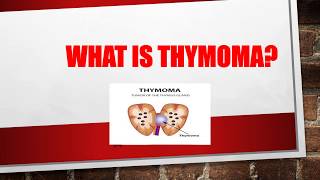 What is Thymoma  What causes thymoma  Thymoma symptoms  Thymoma treatment [upl. by Lindblad]