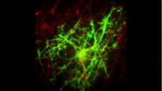 Myelination in Action [upl. by Lynch]