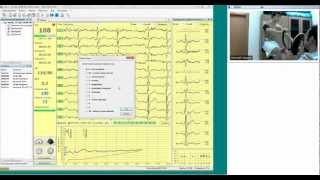 Основы ЭКГ вебинар ч2 [upl. by Waddle]