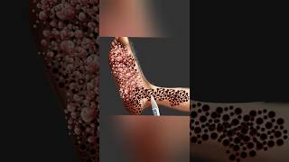 ASMR REMOVE TINY PEBBLES FROM FOOT asmr satisfyingasmr animation [upl. by Abeu]