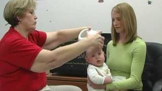 Cranial Remolding Orthoses amp STARscanner Part 2 [upl. by Petulia42]