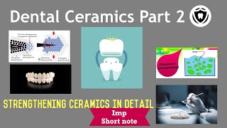 Dental Ceramics  Part 2 [upl. by Eltsirc]