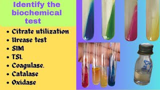 Biochemical Test  Bacterial Identification Technique Microbiology Practical Exam bacteriology [upl. by Ninnahc]