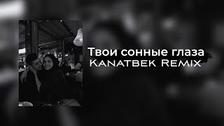 Твои сонные глаза Kanatbek Remix [upl. by Tildy]