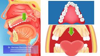 Video Respiracion Bucal by Dr Germán Ramírez Version Español [upl. by Weinman355]