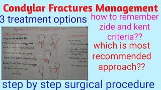 Condylar fractures management [upl. by Satterlee]