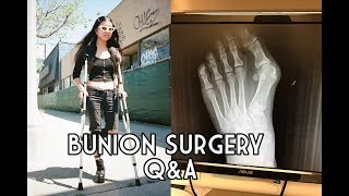 Bunion Surgery QampA  How Much Did It Cost Did it Hurt [upl. by Esila]