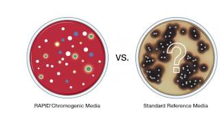 RAPIDChromogenic Media Solutions [upl. by Enneyehc]