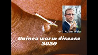 Guinea worm disease 2020 with the Carter Center’s Adam Weiss [upl. by Ajay]