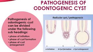 Pathogenesis of Odontogenic Cyst [upl. by Ahsilek]