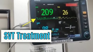 Adenosine in Supraventricular tachycardia SVT How to administer and how it works [upl. by Llywellyn]