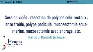 Session vidéo  résection de polypes colorectaux  Thomas Di Bernardo [upl. by Einnalem]