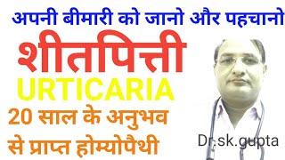 what is the best homeopathic medicine for urticaria शीतपित्ती का होम्योपैथी इलाज।drskgupta [upl. by Aratihc]