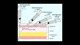 intermuscularhospital view viralvideo youtubetrending medicalstudent [upl. by Barnett369]