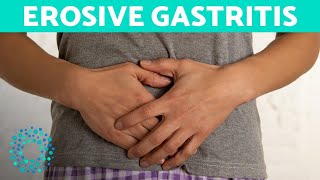 EROSIVE GASTRITIS  Belly Pain And Vomiting [upl. by Aikas259]