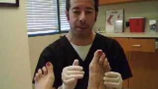 Bunions by Dr Leo Krawetz Understanding Bunions [upl. by Si]