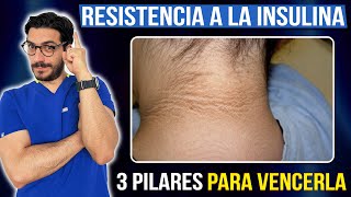 3 Pilares para vencer la resistencia a la insulina DoctorMauInforma [upl. by Attennaej596]