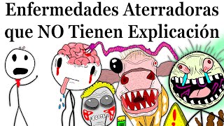 Enfermedades Más Aterradoras que la Ciencia NO Puede Explicar [upl. by Joappa]