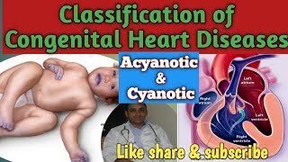 Classification of CHDs  Acyanotic amp Cyanotic Heart Diseases  Physiological classification of CHD [upl. by Swor]