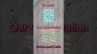 Cells Under Microscope Ovum Cells Muscle Cells Onion Peel Cells and Blood Cells  LP [upl. by Correna]