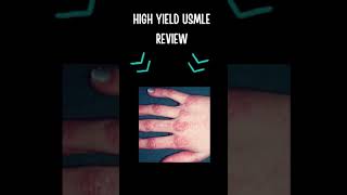 Dermatomyositis Review shorts [upl. by Oneill]