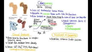 Osteomalacia Vs Osteoporosis Vs Osteopenia [upl. by Aneeuq]