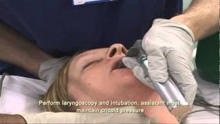 Intubation Extubation 37 [upl. by Marne685]