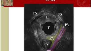 ICS 2013  Imaging 2  Abstract 133 Lieschen H Quiroz [upl. by Colan]